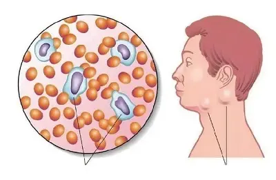 依鲁替尼（Ibrutinib）的每日用量多少？用法需要注意些什么？