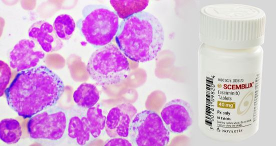 Asciminib（阿西米尼）如何对抗 CML？