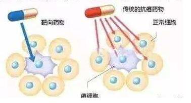 贝组替凡与卡博替尼：联合用药在癌症治疗中的新突破